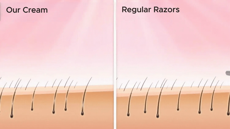 Trusted by Over 50,000+ Women Who Finally Said Goodbye to Razor Bumps, Ingrowns, and Painful Hair Removal