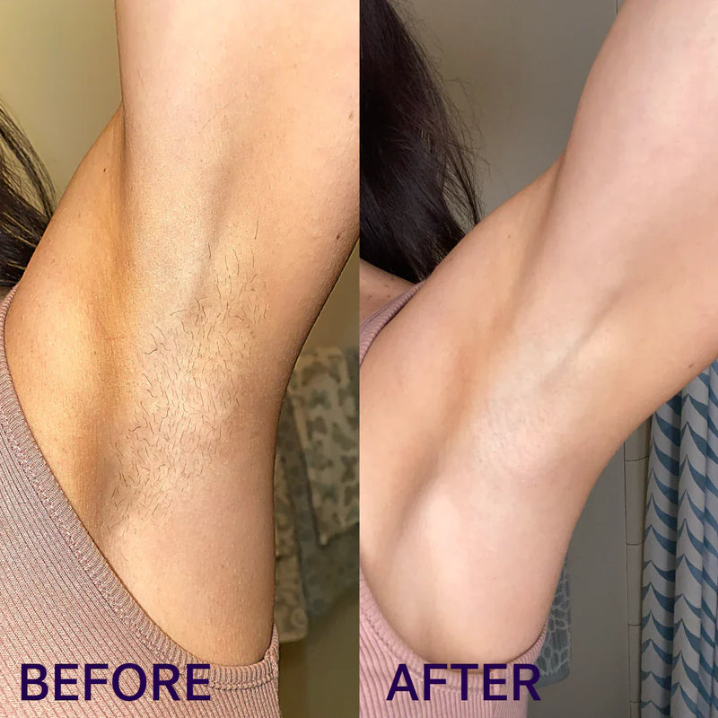Results That Last 3-4 Weeks — And Hair Grows Back Finer Every Time