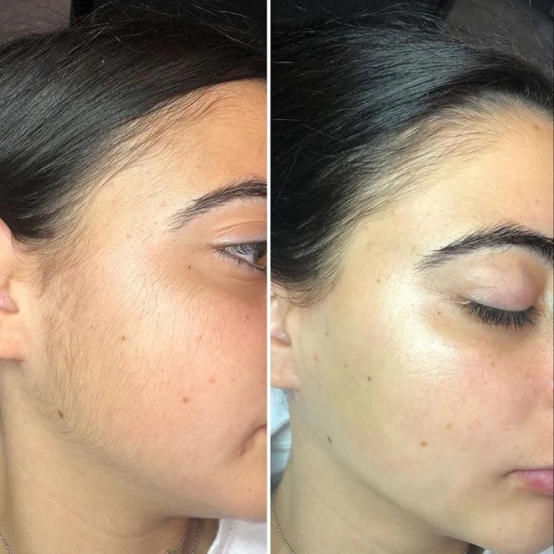 It Breaks the Exhausting Daily Hair Removal Cycle (Finally, Freedom Without Pain)