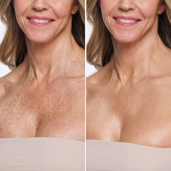 The Undo Button Your Skin Has Always Deserved.