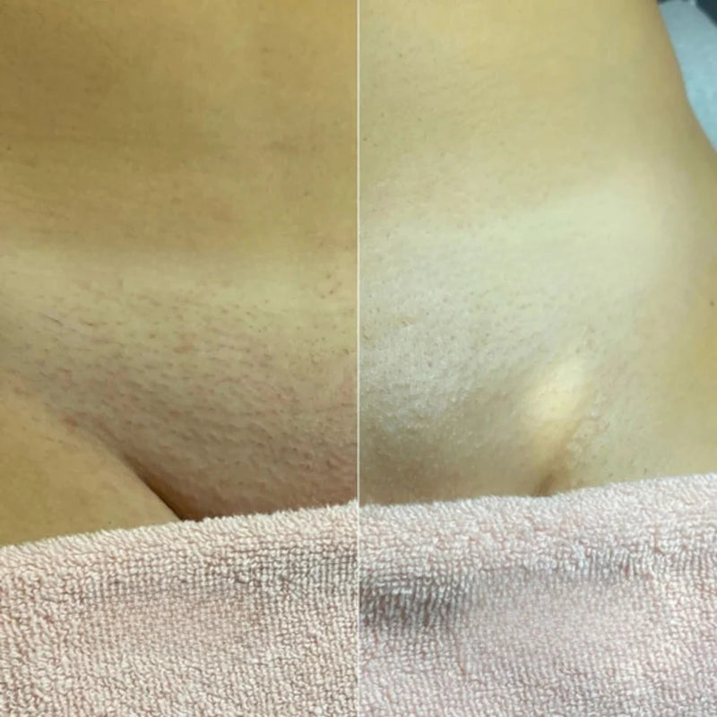 Sicher für Ihre empfindlichsten Bereiche: Gesicht, Körper und Intimzonen