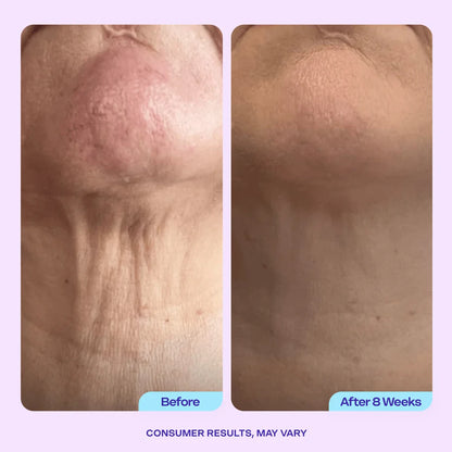 Tighten & Lift Neck Cream