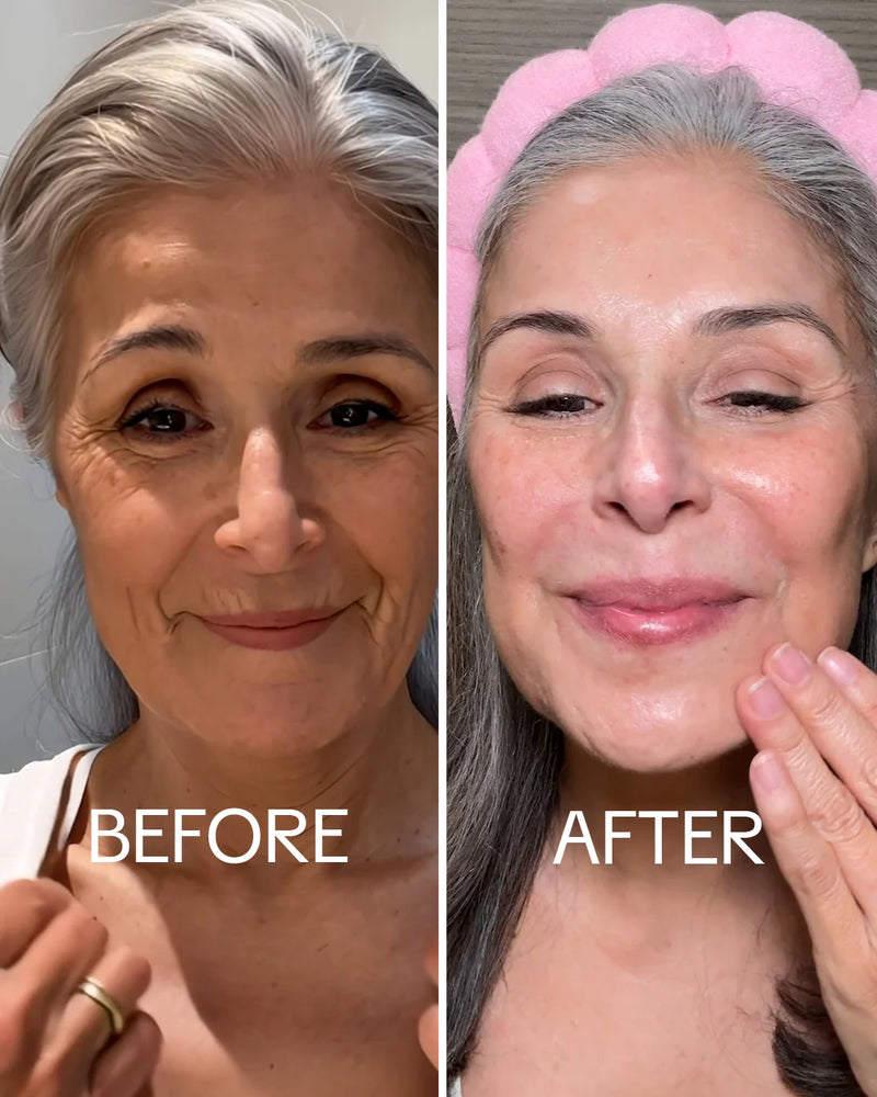 From Fine Lines at 35 to Deep Wrinkles at 65 — It Works for Every Age