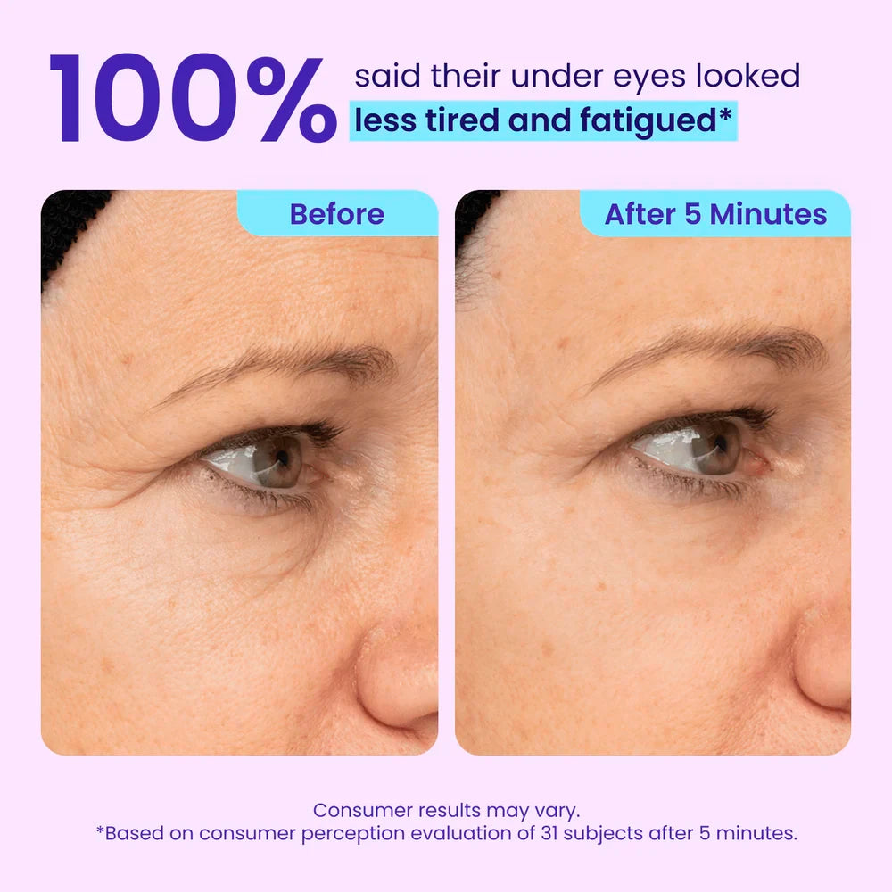 Instant Lift Eye Gel