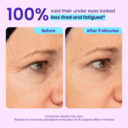 Instant Lift Eye Gel
