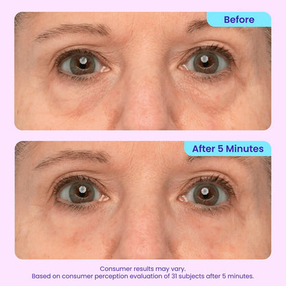 Instant Lift Eye Gel