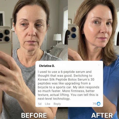 Lift Your Face Like $3,000 Thread Lift Procedures
