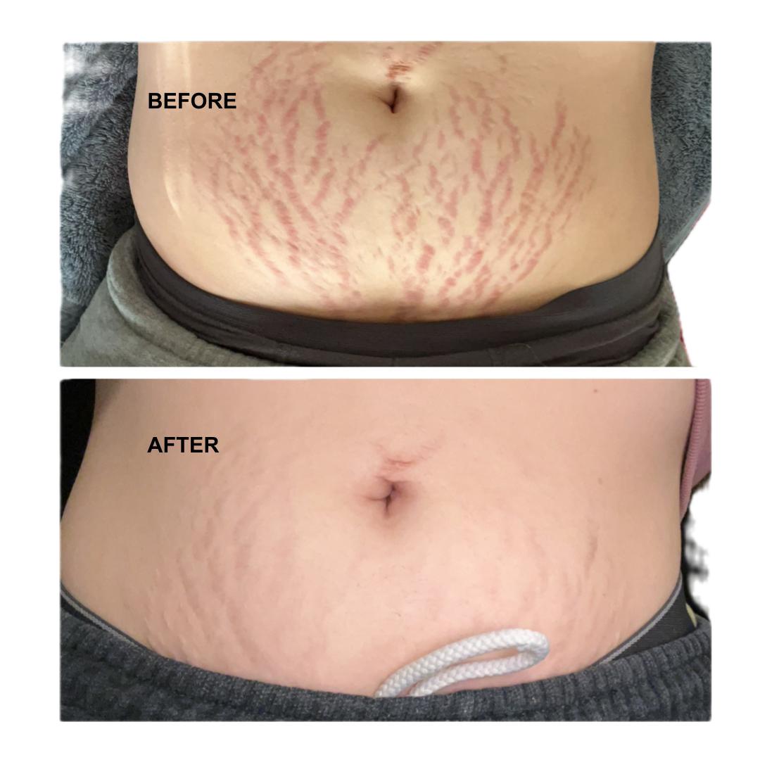 NovaGlow's Belly Serum