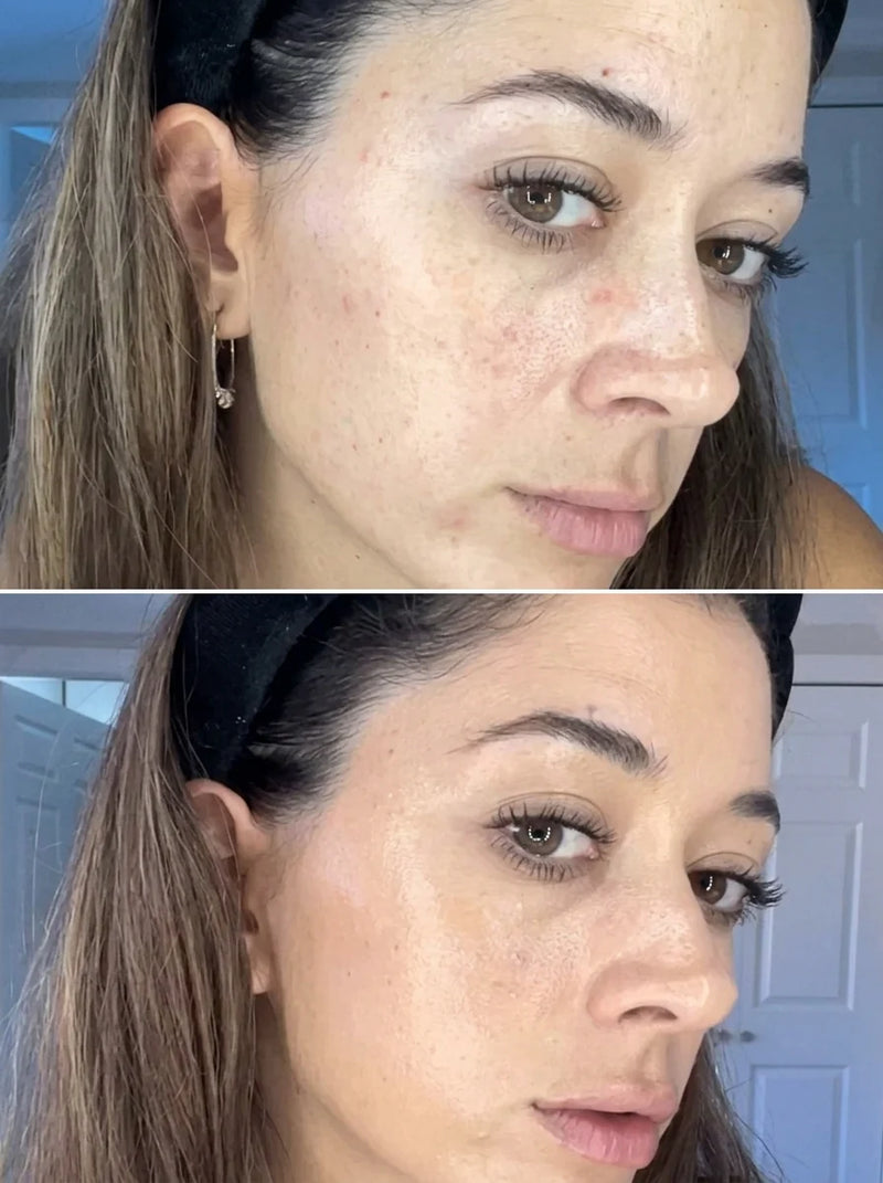 Perfect Complexion for All Skin Tones