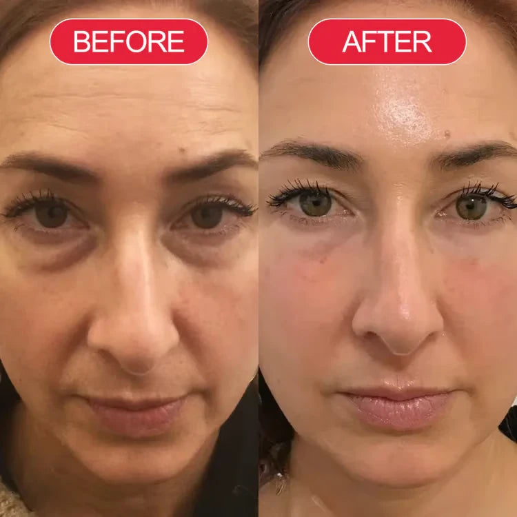 3. Rebuilds Your Skin's "Bounce-Back"