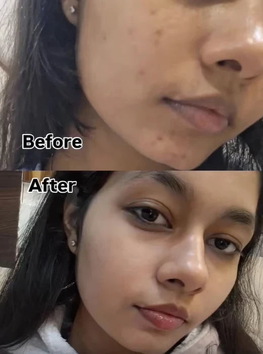 4. Wipes Away Dark Spots & Old Scars