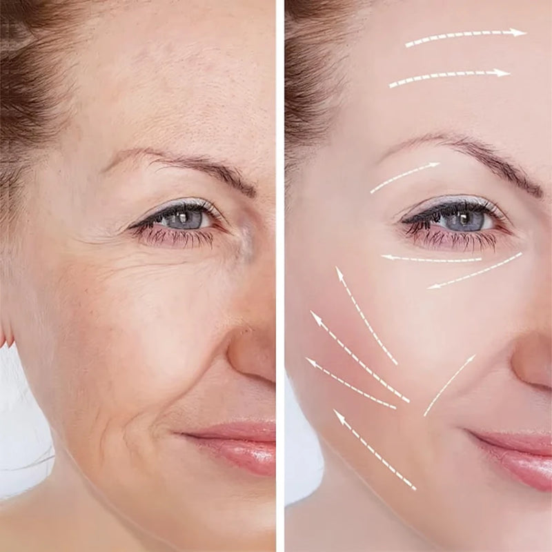 5. Erases Rough, Dry Texture