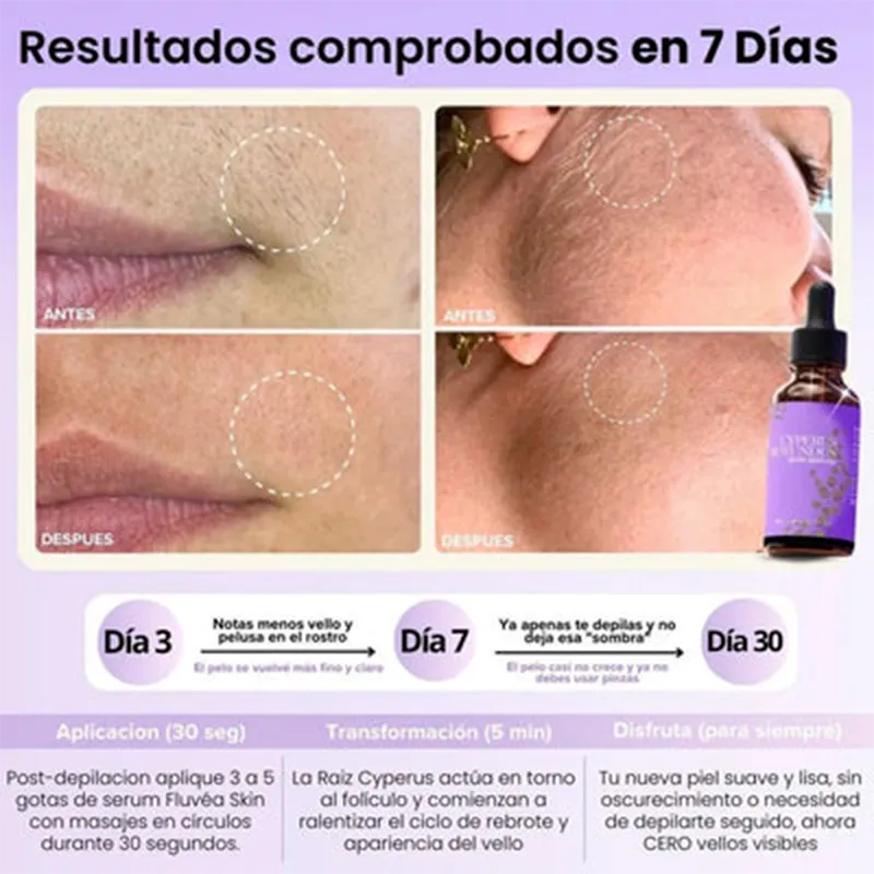 Cyperus Rotundus Hair Growth Reduction Serum  Best Seller